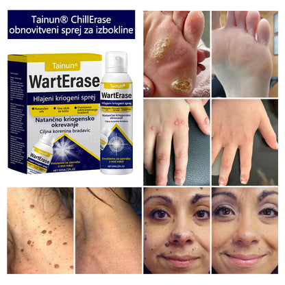 Tainun® ChillErase – spray za obnovo brazgotin po aknah ✨ | Varno odstranjuje kožne oznake, madeže & bradavice doma ✅