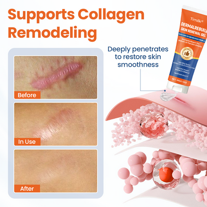 🌟 Vosxu® DermalRebuild Gel za Obnovo Kože – Za Strije, Brazgotine, Akne in Neenakomerno Teksturo | Vidno Bolj Gladka Koža v 7–14 Dneh 💎