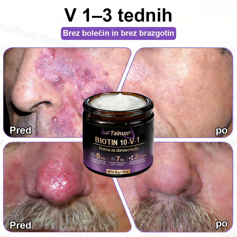 Tainun® Biotin 10-v-1 krema za obnovo kože ✨ proti staranju, luskavici, aknam, brazgotinam, pigmentaciji, suhosti, vnetjem & intimnemu nelagodju 🌿 z naravnimi bioaktivnimi sestavinami 💧 za gladko, čvrsto & mladostno kožo 🌸