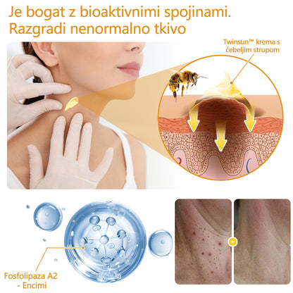 🐝Twinsun™ Izjemno Močna Krema z Čebeljim Strupom, s certifikatom EMA💖 Za zdravljenje bradavic, kožnih izrastkov, okužb in keratoze, ter za glajenje neenakomerne kože