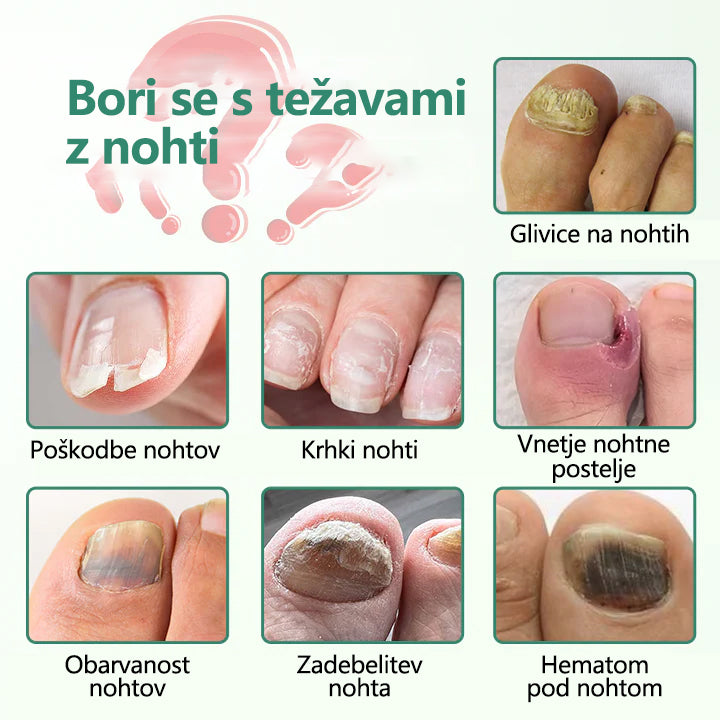 Zelviora® Serum Pen za globinsko nego in obnovo nohtov ✨ Napredna mikro-molekularna formula za obnovo nohtov 💧 Globinsko delovanje ✔️ Podpira zdravo rast nohtov ⏱️ Vidni rezultati v 7–21 dneh 🔥