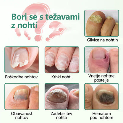 Zelviora® Serum Pen za globinsko nego in obnovo nohtov ✨ Napredna mikro-molekularna formula za obnovo nohtov 💧 Globinsko delovanje ✔️ Podpira zdravo rast nohtov ⏱️ Vidni rezultati v 7–21 dneh 🔥