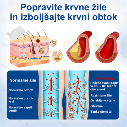 ✨ Twisma® VeinTarget: Napreden transdermalni sistem za zdravljenje kronične venske insuficience 🌿  Prvi EU-certificiran 🇪🇺 in GMP-certificiran ⚕️ alpski zeliščni mikroigelni obliž. Klinično dokazana 96-odstotna uspešnost 📊 Vidni rezultati v 7–14 dneh 🔥🔥