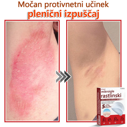 GFOUK® Rastlinski Mikronidling obliži za odstranjevanje kožnih izrastkov✨ – 🩹 Neboleče | 🚫 Brez Brazgotin | 🌿 Naravne Mikroiglice | 🎯 Globinsko Delovanje | 🛡️ Varno za Občutljivo Kožo | 📦 9 kosov | 🇪🇺 Medicinski Razred I |