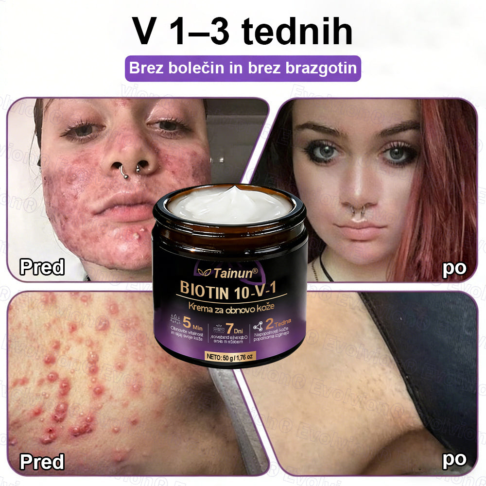 Tainun® Biotin 10-v-1 krema za obnovo kože ✨ proti staranju, luskavici, aknam, brazgotinam, pigmentaciji, suhosti, vnetjem & intimnemu nelagodju 🌿 z naravnimi bioaktivnimi sestavinami 💧 za gladko, čvrsto & mladostno kožo 🌸