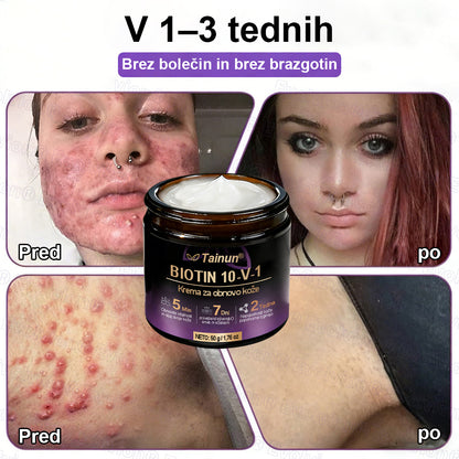 Tainun® Biotin 10-v-1 krema za obnovo kože ✨ proti staranju, luskavici, aknam, brazgotinam, pigmentaciji, suhosti, vnetjem & intimnemu nelagodju 🌿 z naravnimi bioaktivnimi sestavinami 💧 za gladko, čvrsto & mladostno kožo 🌸